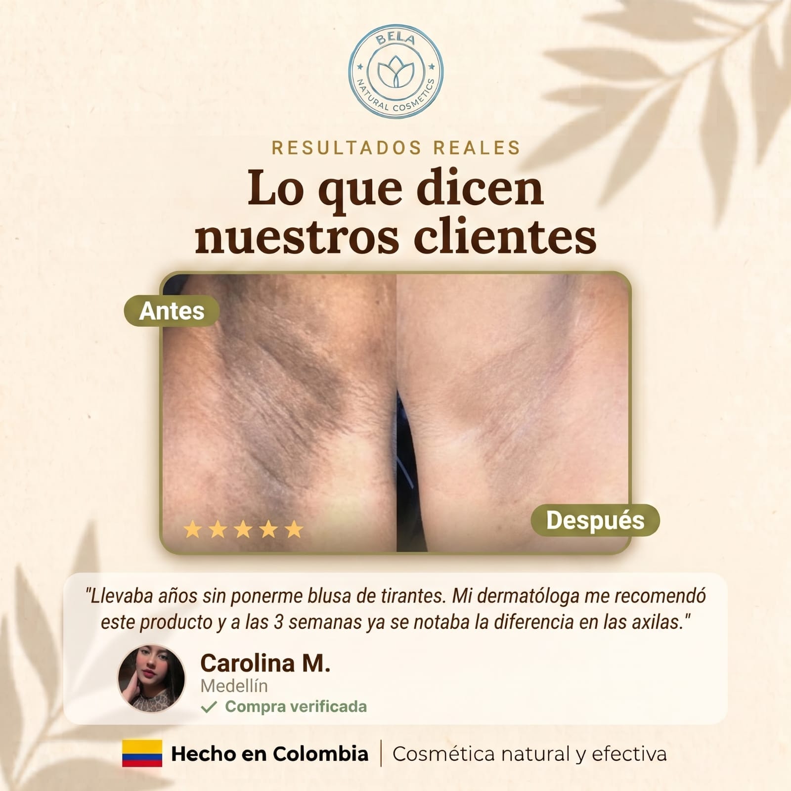 Antes y después de clienta Bela: aclaramiento de manchas en la axila